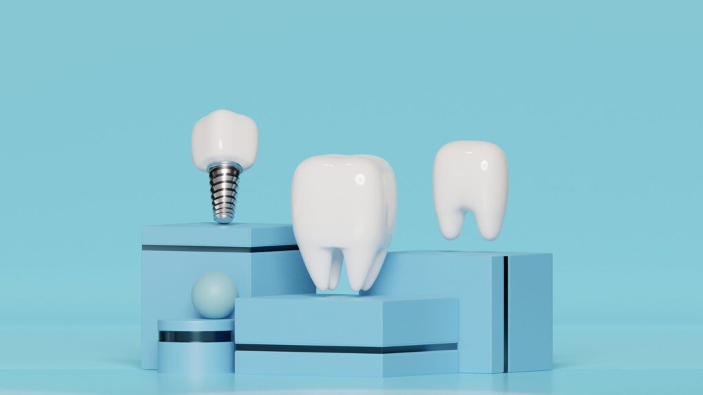 12.24.24 dental implant CREDIT freepik