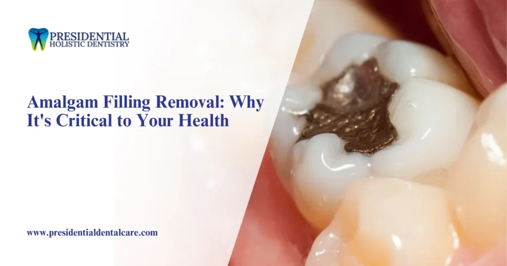 Amalgam Filling Removal Why It's Critical to Health