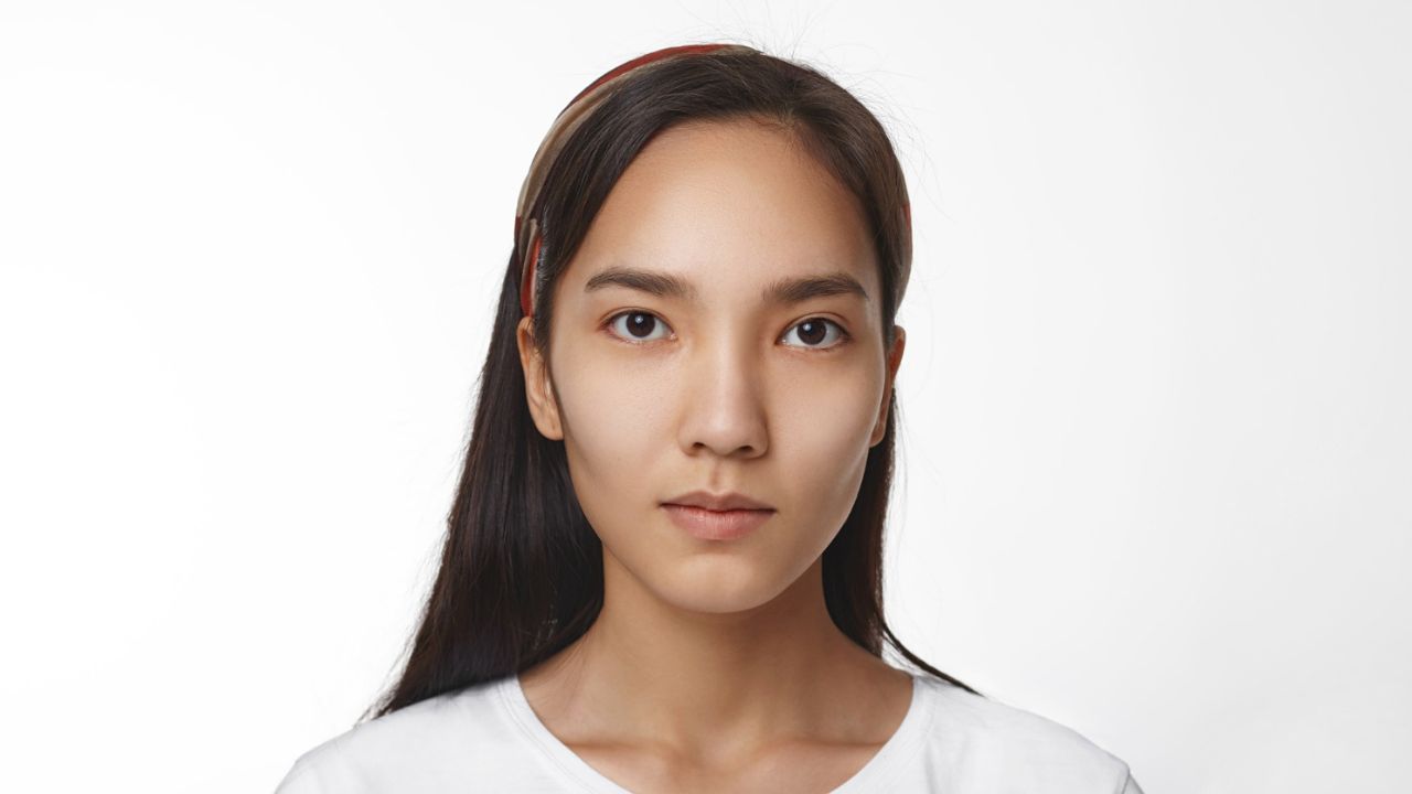 Facial Asymmetry & TMJ Disorder