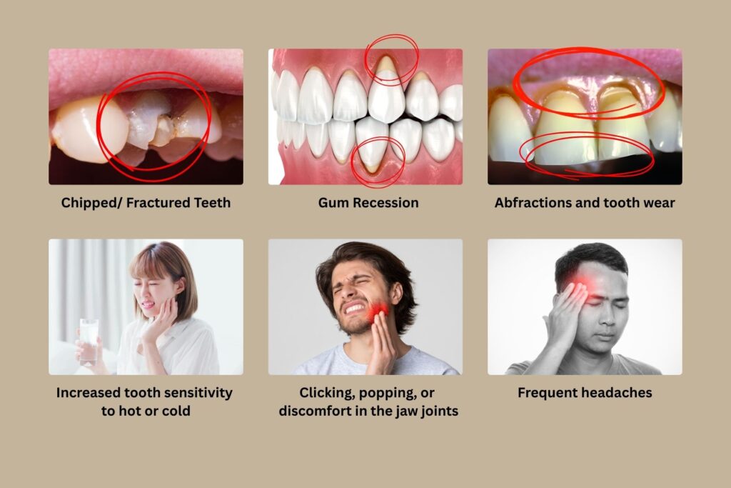 What Is Occlusal Disease — and Why It Can Quietly Damage Your Teeth
