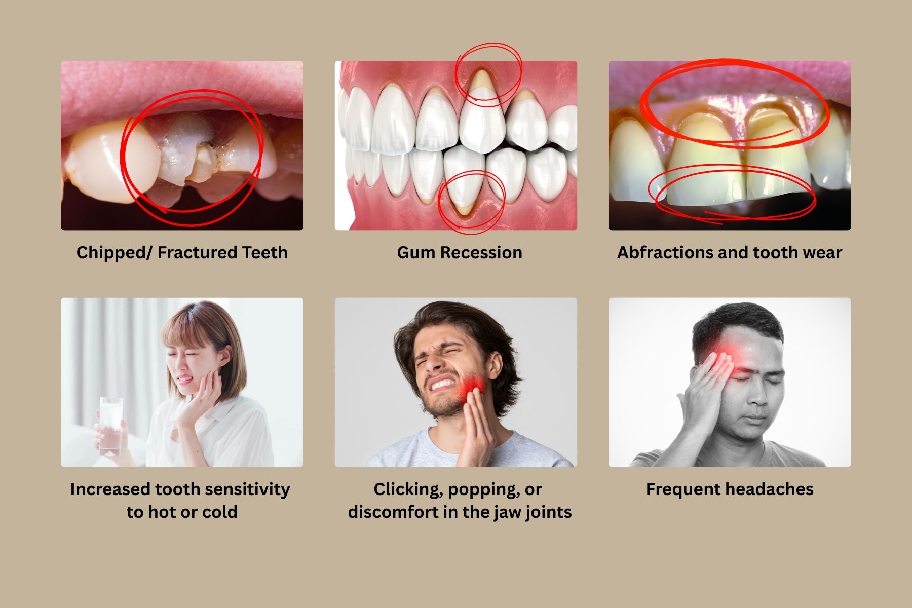 What Is Occlusal Disease — and Why It Can Quietly Damage Your Teeth